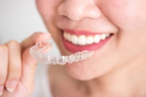 Invisalign Braces in Hilliard