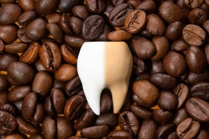 Tooth stained with coffee and tea illustrating extrinsic stains targeted by Zoom! whitening at Fishinger