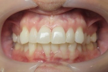 Before image