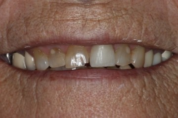 Before image