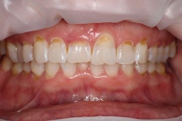 Before image