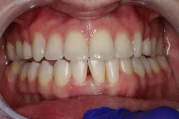 Before image