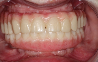 Before image