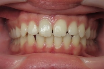 Before image