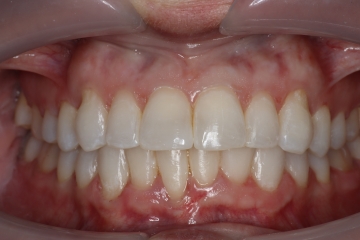 After image