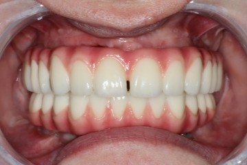 After image