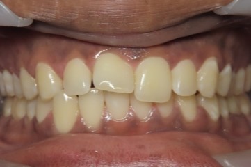 Before image